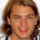 Emile Hirsch Rehab After Felony Assault Charge