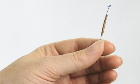 IUD Implant Study