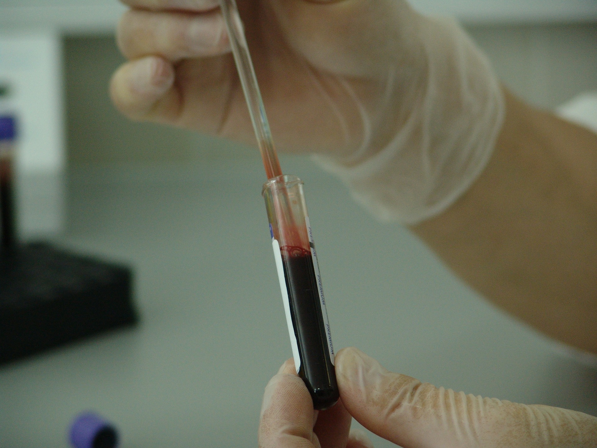 Blood Test Vial