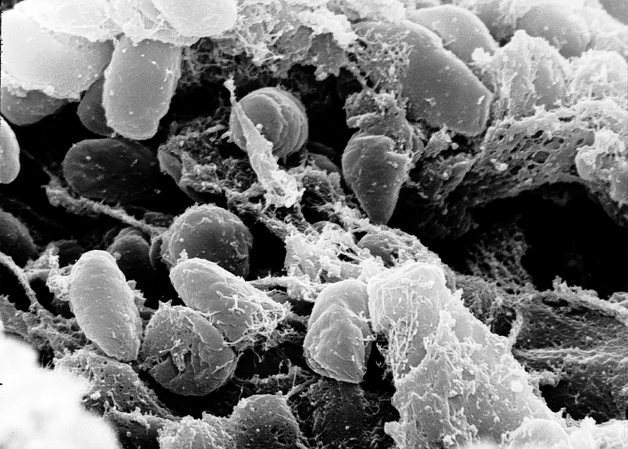 Bubonic Plague Bacteria