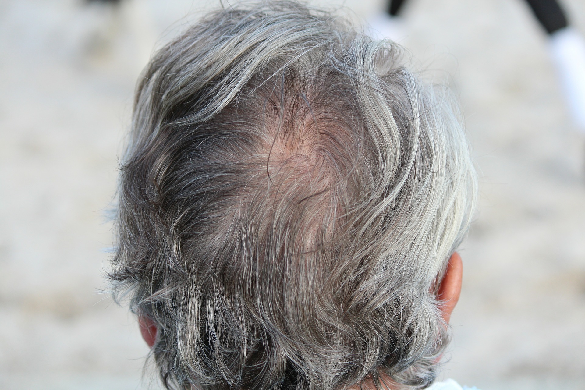 Grey Hair Head